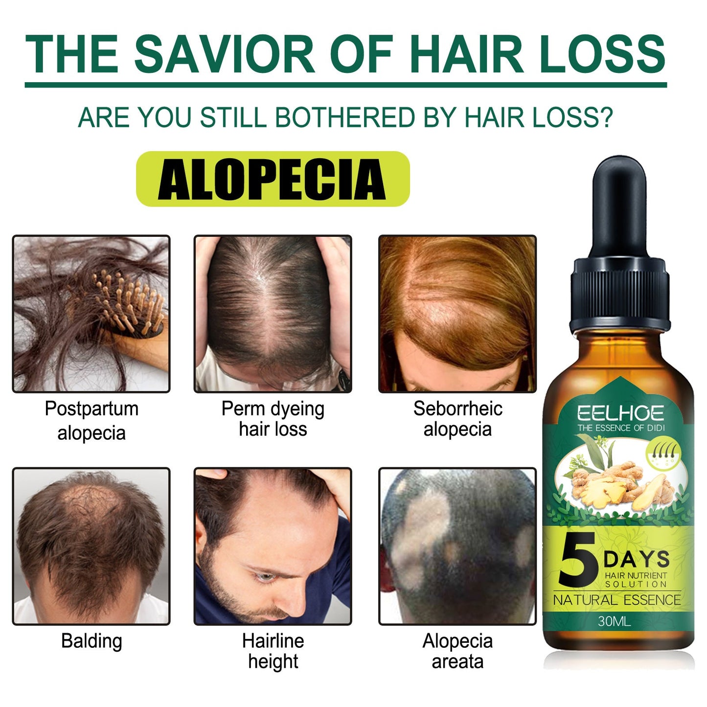 Eelhoe Ginger Hair Essential Oil for Hair Growth and Anti Hair Loss