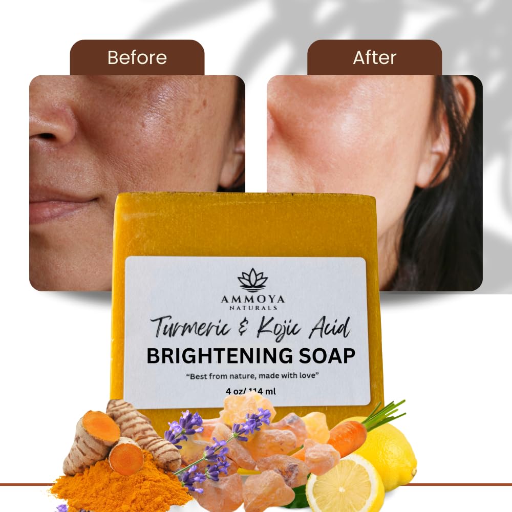 Turmeric Skin Cleansing Soap  1 bar (4.5 oz)