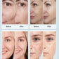 MOLAMOYA Led Light Therapy Mask