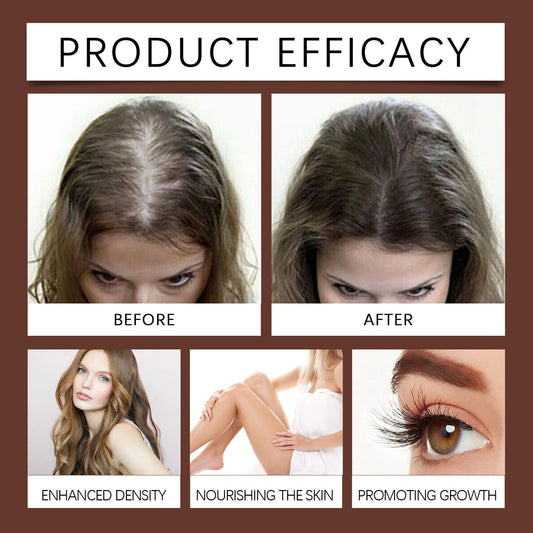 Xiyue All in One Castor Oil for Skin Eyelashes and Eyebrows