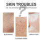 Blackhead Cleansing Cream Exfoliating Pore Repair Nose Patch