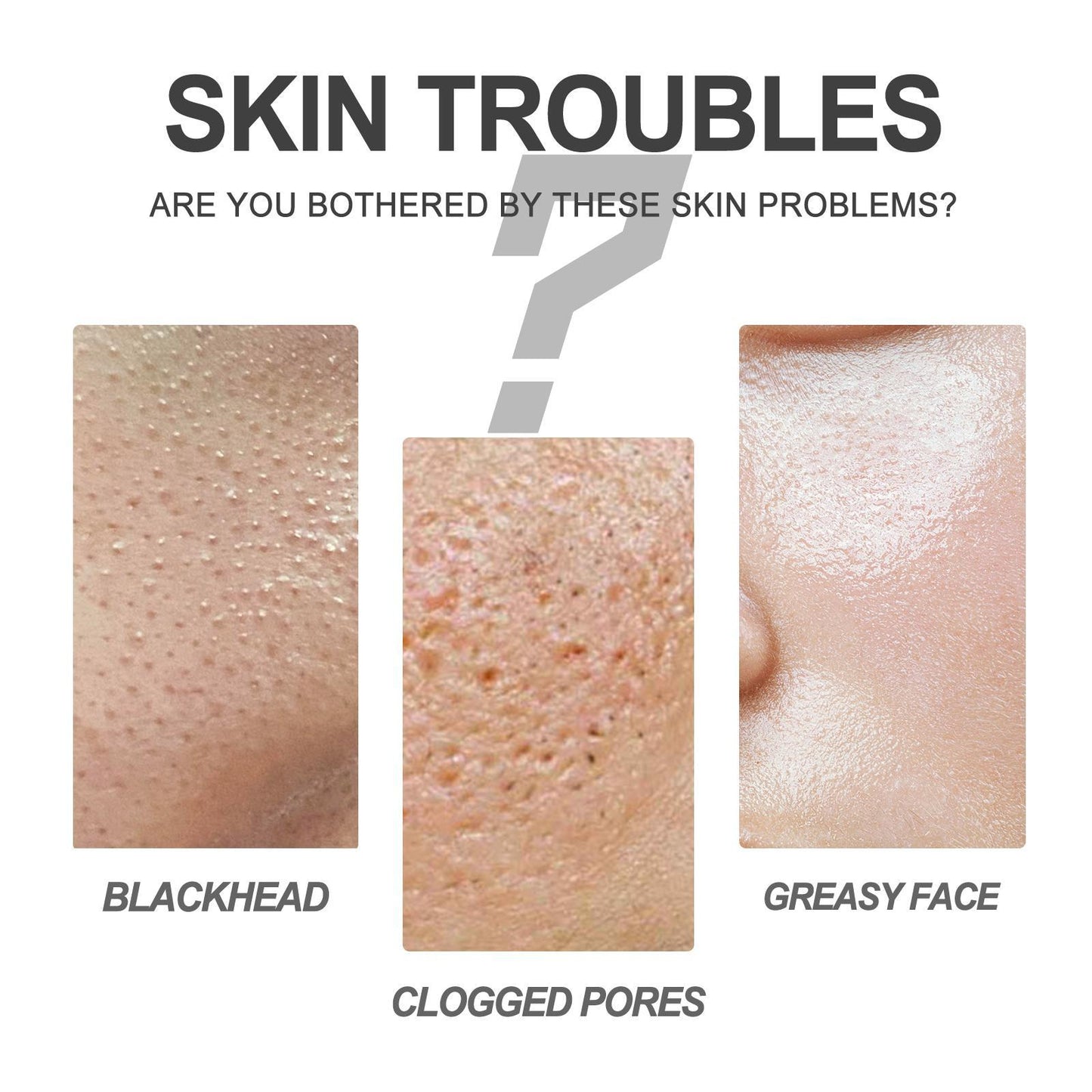 Blackhead Cleansing Cream Exfoliating Pore Repair Nose Patch